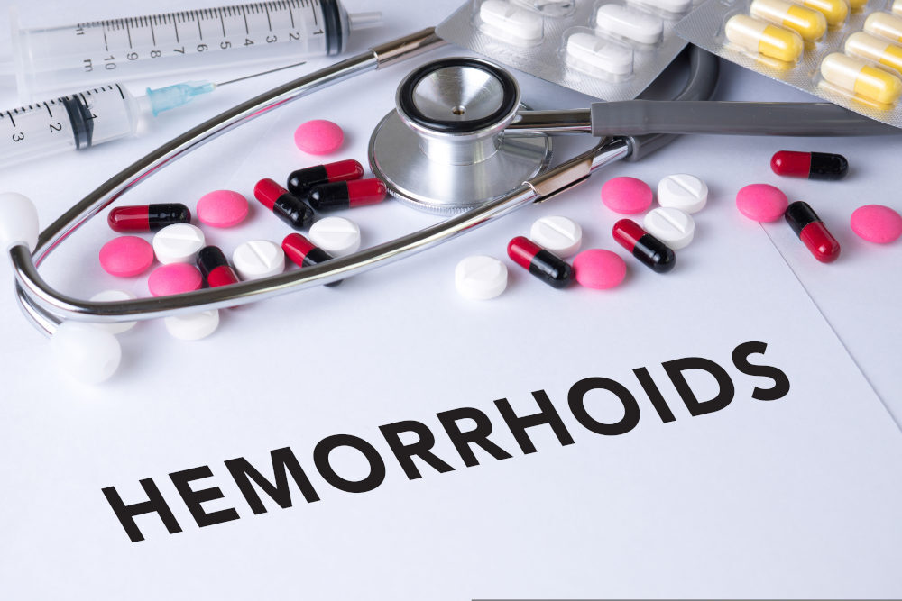 leczenie hemoroidów